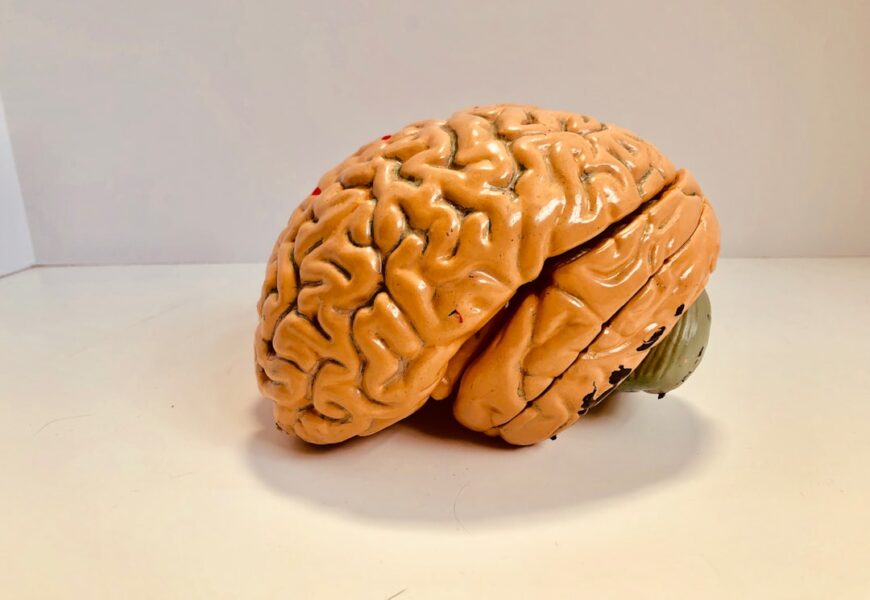 Photo Image: Brain Diagram