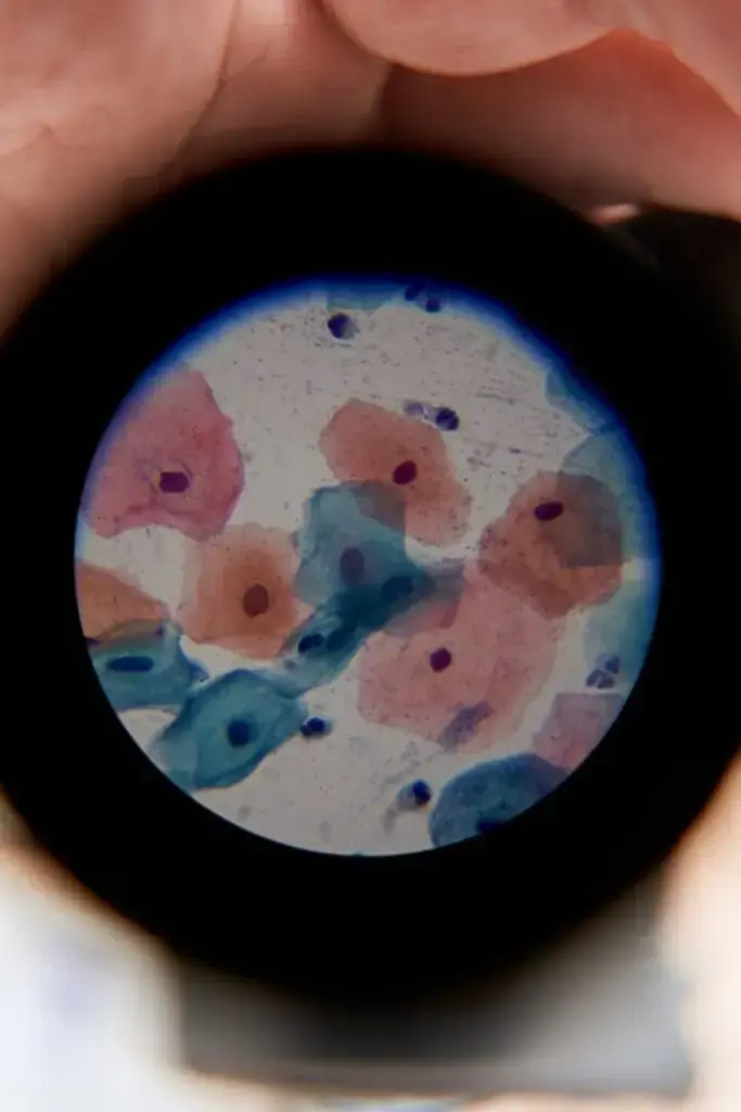 Cytology Specimen