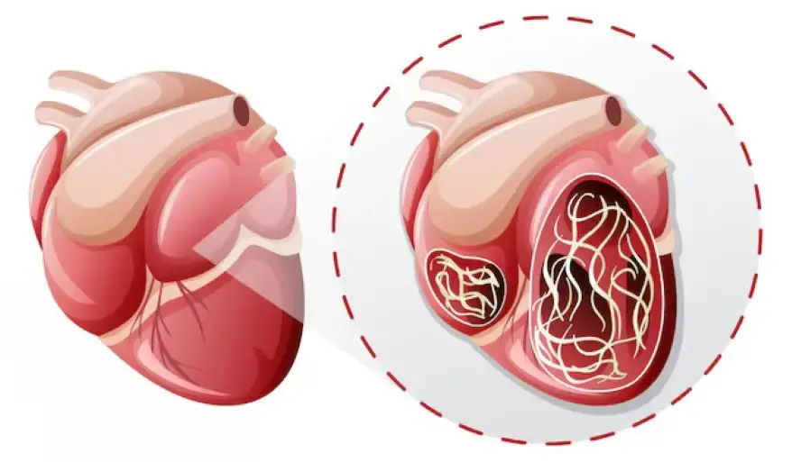 Cardiac Cycle