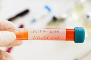 Epstein-Barr Virus
