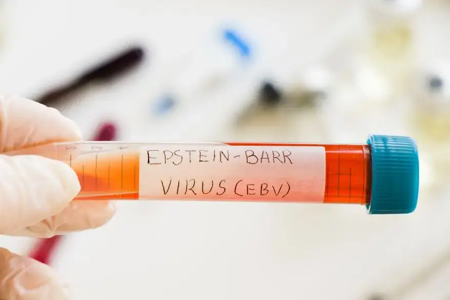 Epstein-Barr Virus