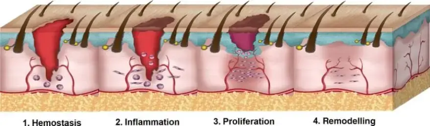 Wound Healing Process